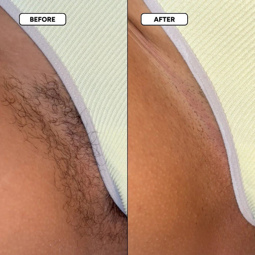The Smooth Skin System