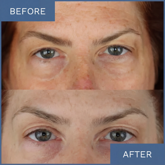 Feature product image