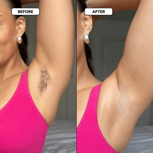 The Smooth Skin System
